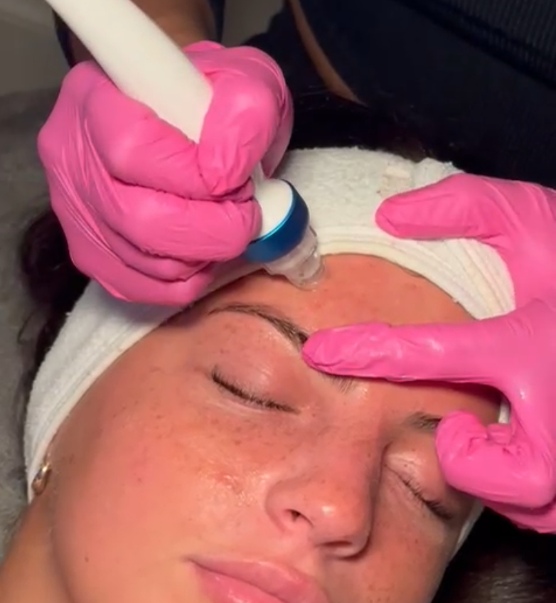 Hydra facial treatment