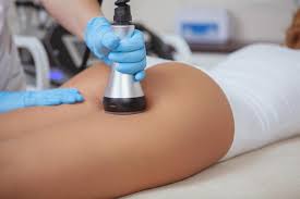 Body Contouring Treatments