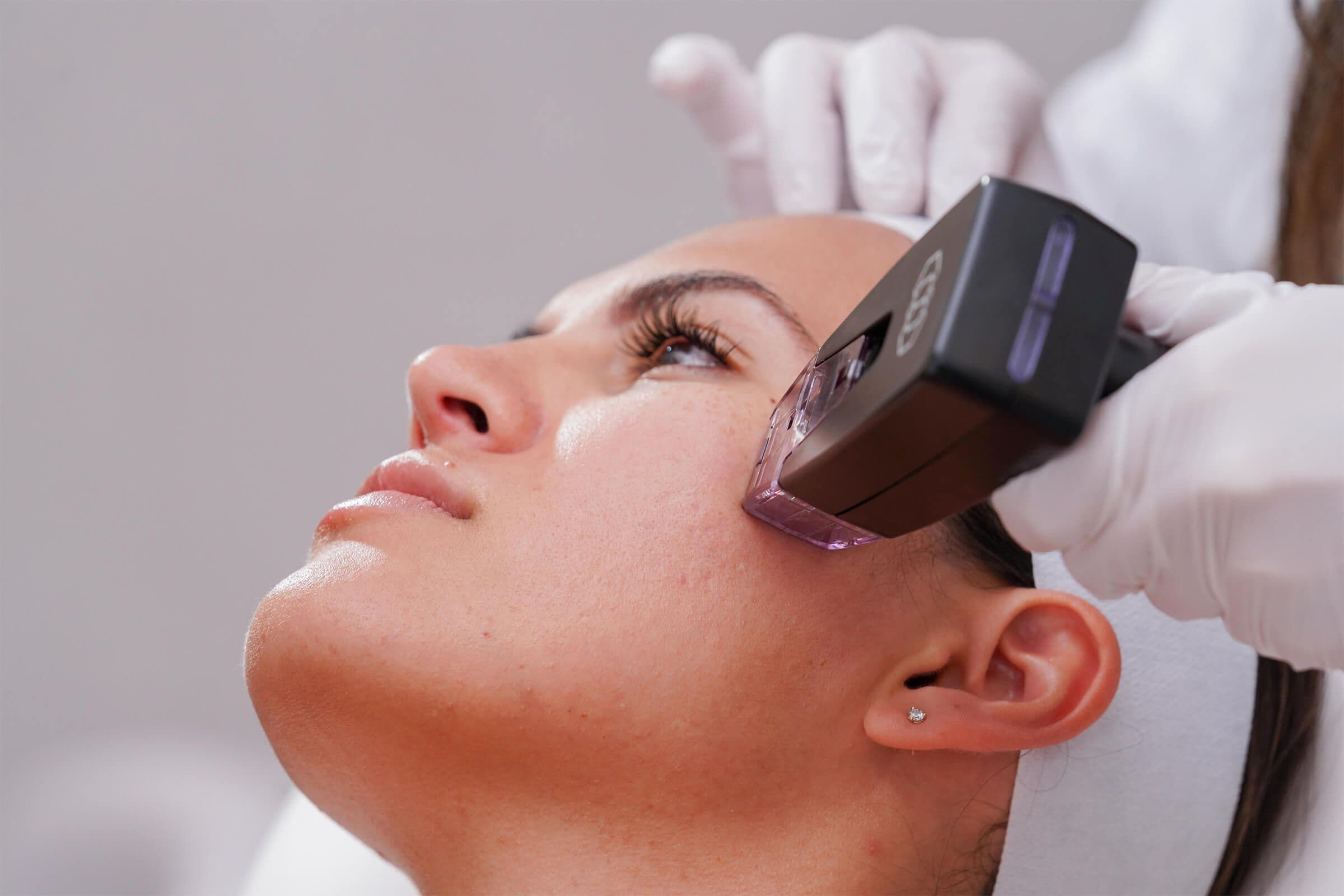 Skin Treatments - Morpheus8