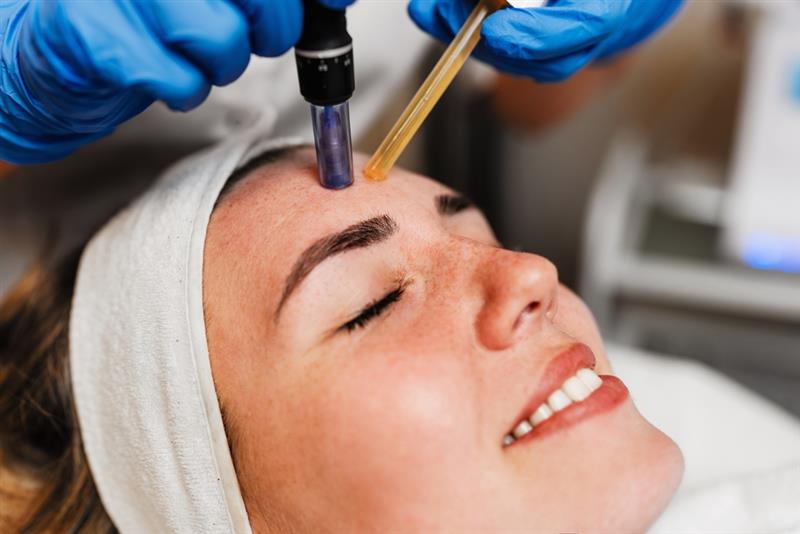Discover the Transformative Power of Microneedling at Nova Med Spa